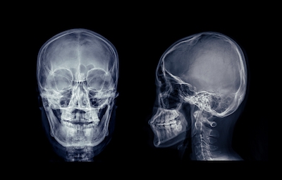 The brain uses an individual’s facial bone structure as part of its determination of whether they are trustworthy.