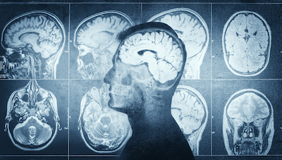 What is happening in the brain when we feel trust?
